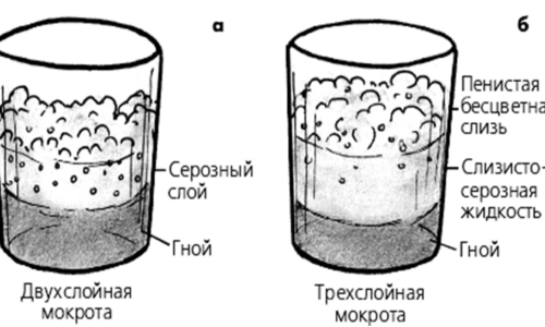 Каким должен быть анализ мокроты